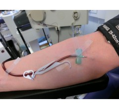 Image for FDA Issues Warning Over Young Blood Transfusions