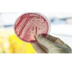 Image for CDC Issues New Report On Drug-resistant Superbugs