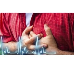 Image for Rising number of cardiac patients in India in 30-40 age group a concern, say doctors