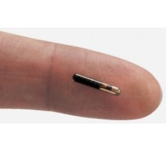 Image for Swedish Start-Up Implants Employees with Microchips